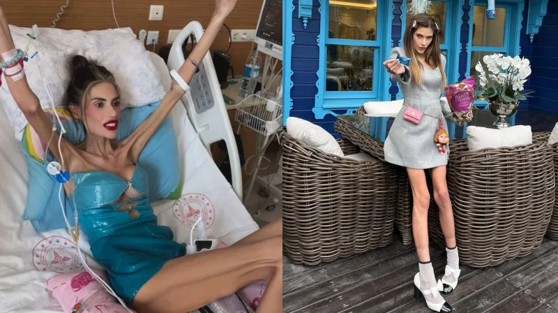 25 kiloya düşen Nihal Candan için düğmeye basıldı!