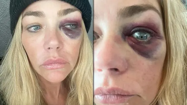 Ünlü Oyuncu Polise Koştu! Eski Eşi Beni Öldürmeye Çalıştı!