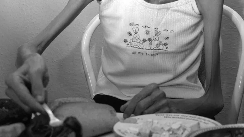 Anoreksiya Nevroza: Nedir, Belirtileri Neler? Şok Eden Gerçekler!