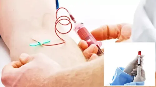 Nadir Hastalıklara Milyarlarca Destek! Hemofili A'da Evde Tedavi Müjdesi!