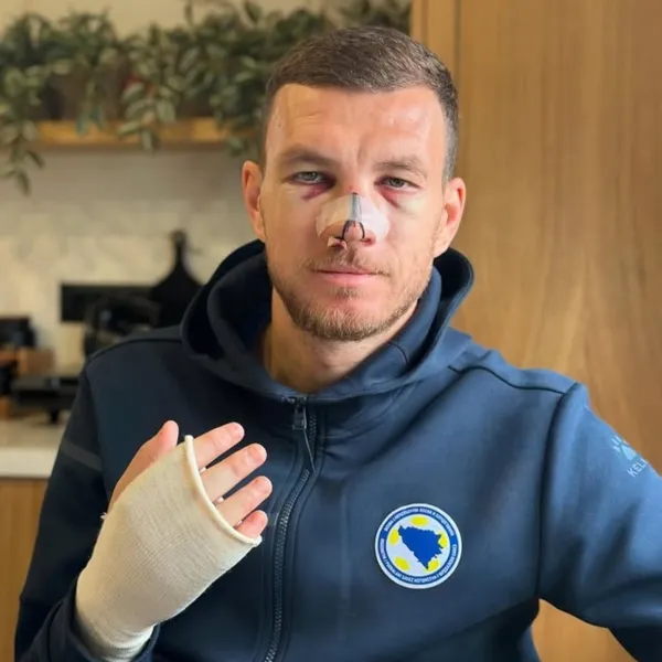 Edin Dzeko'nun Sakatlık Sonrası Görüntüleri Sosyal Medyada