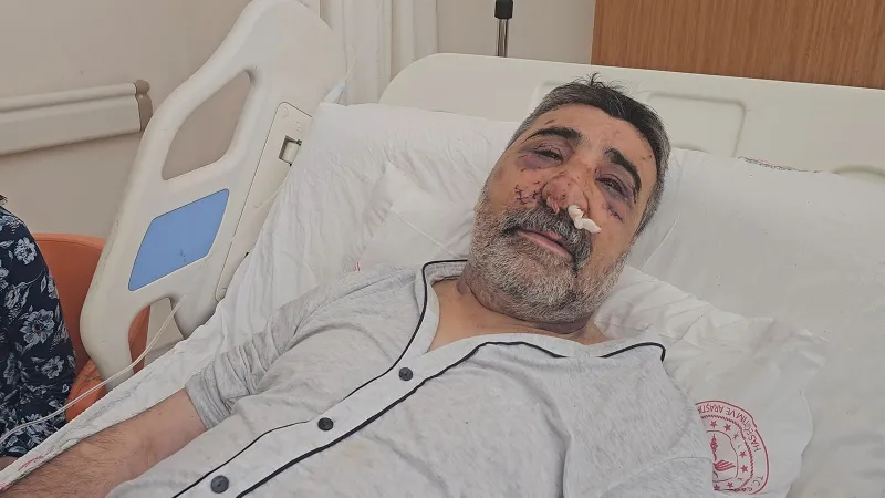 İngiliz Boksör Taksiciyi Isırdı! Şoke Eden Saldırının Detayları
