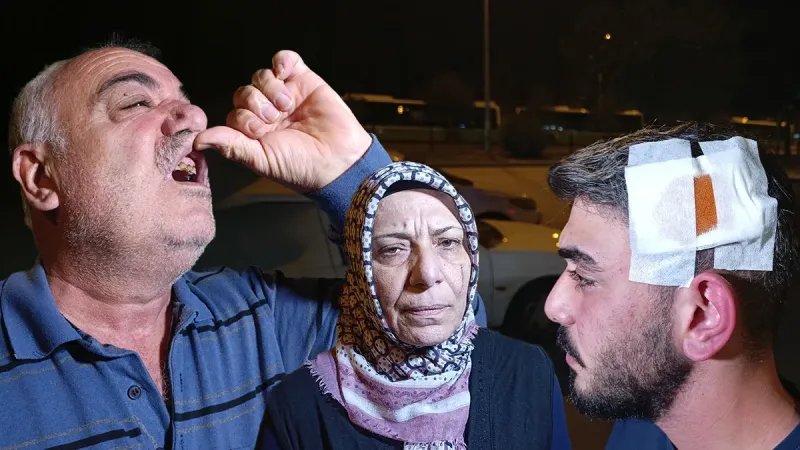 SON DAKİKA… Adana’da öfkeli komşu park yeri yüzünden dehşet saçtı: Anne ile oğlu bıçakladı, babanın dişlerini kırdı!