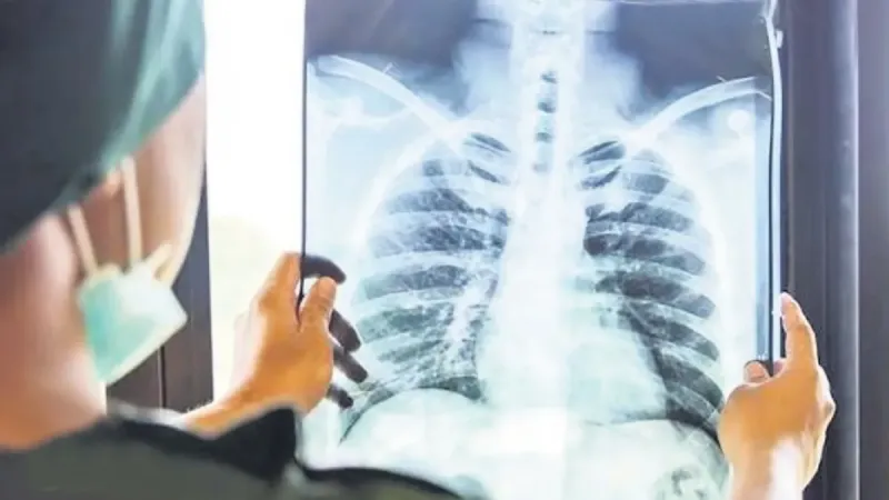 Zatürre Alarmı! Türkiye'de 5. Ölüm Nedeni mi?